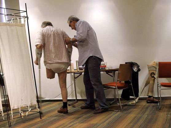  Foto de archivo de una consulta con un paciente con la pierna amputada. (EFE/Nacho Gallego)